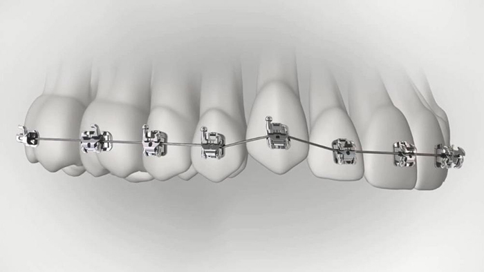 承德市哪家口腔醫院口腔正畸做得好？惟德口腔醫院來告訴您
