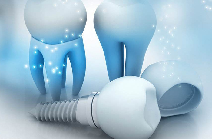 惟德口腔醫院口腔種植價格表一覽2020