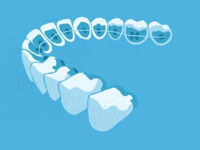 惟德口腔醫院口腔正畸好不好？